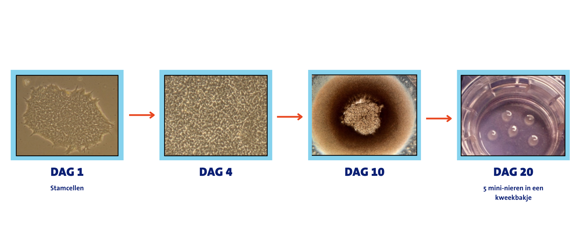 Kweken van mini-nieren vanuit menselijke stamcellen